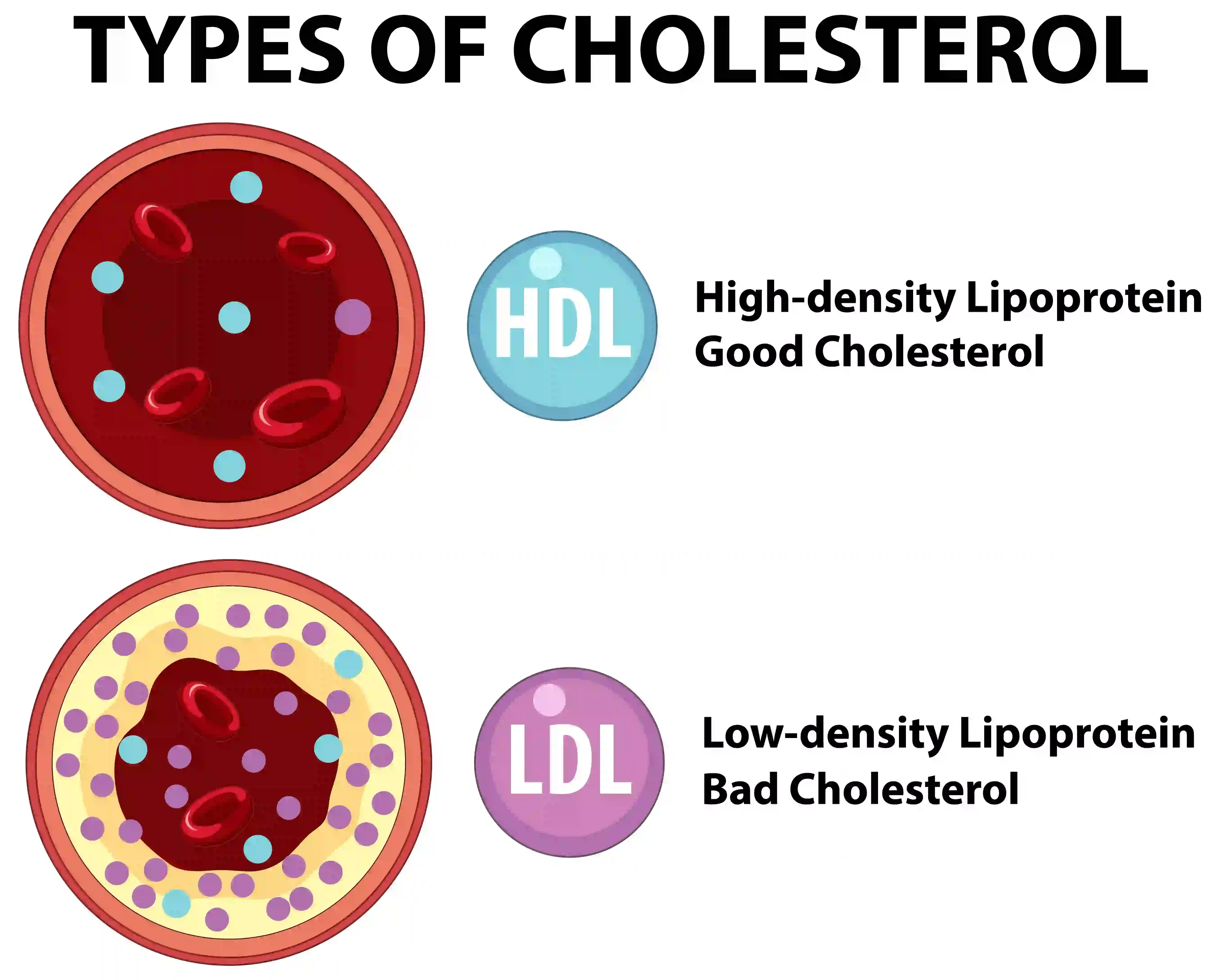 Cholesterol health